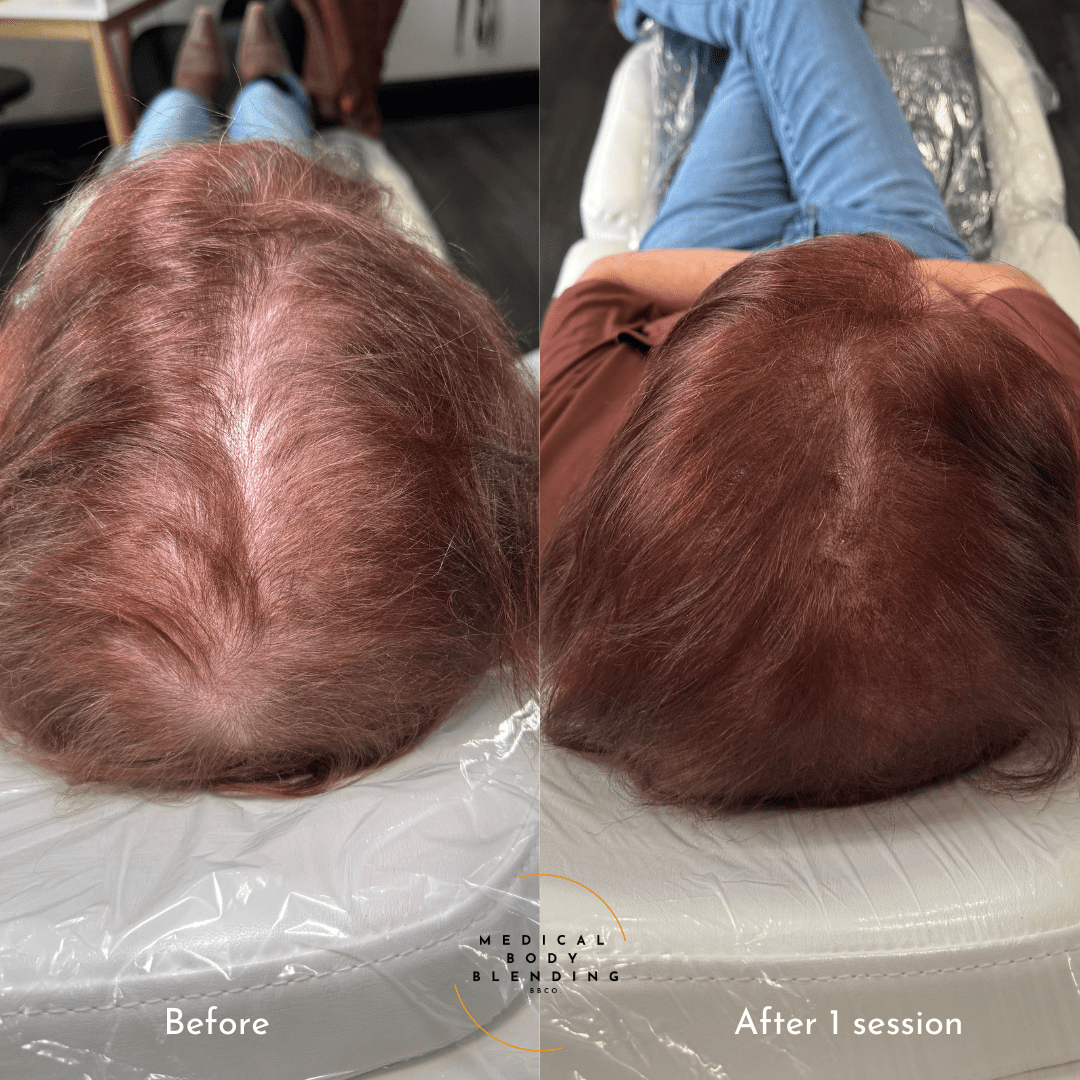 female hair loss treatment 1